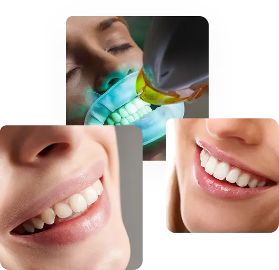 strahlende Zaehne (collage)