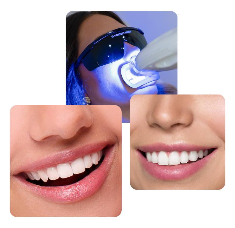 strahlende Zaehne (collage)