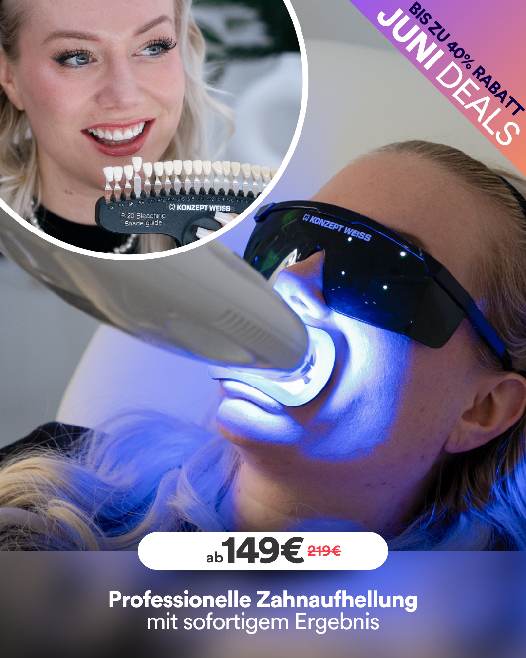 Gutschein für ein Bleaching Vor Ort - Superdeal