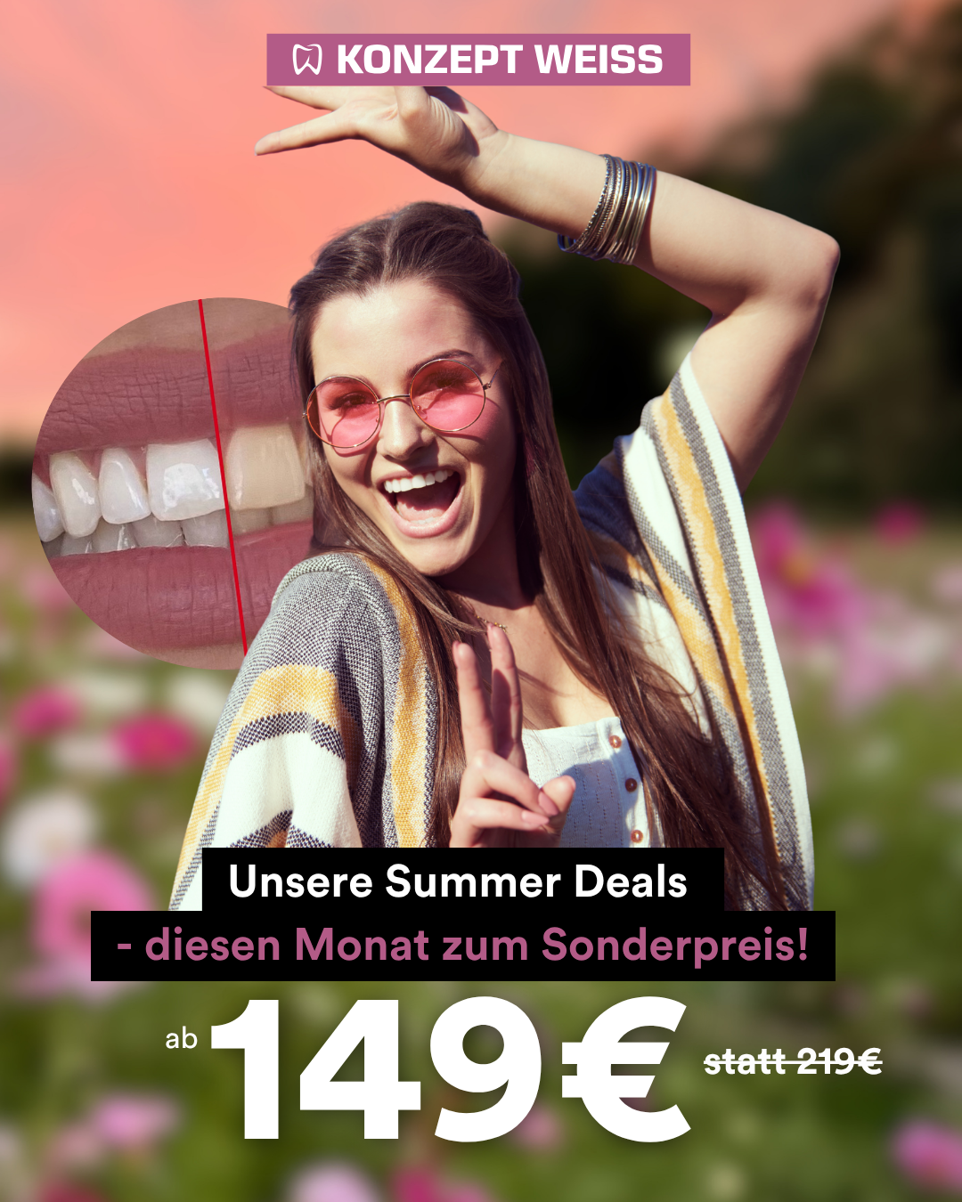 Gutschein für ein Bleaching Vor Ort - Sonderangebot